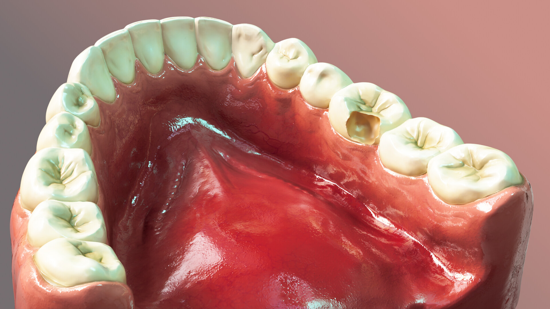 3D dental anatomy for Bonding Mechanism